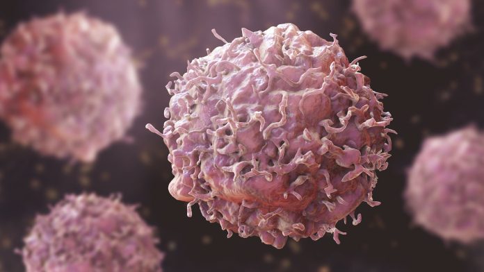 Cancer